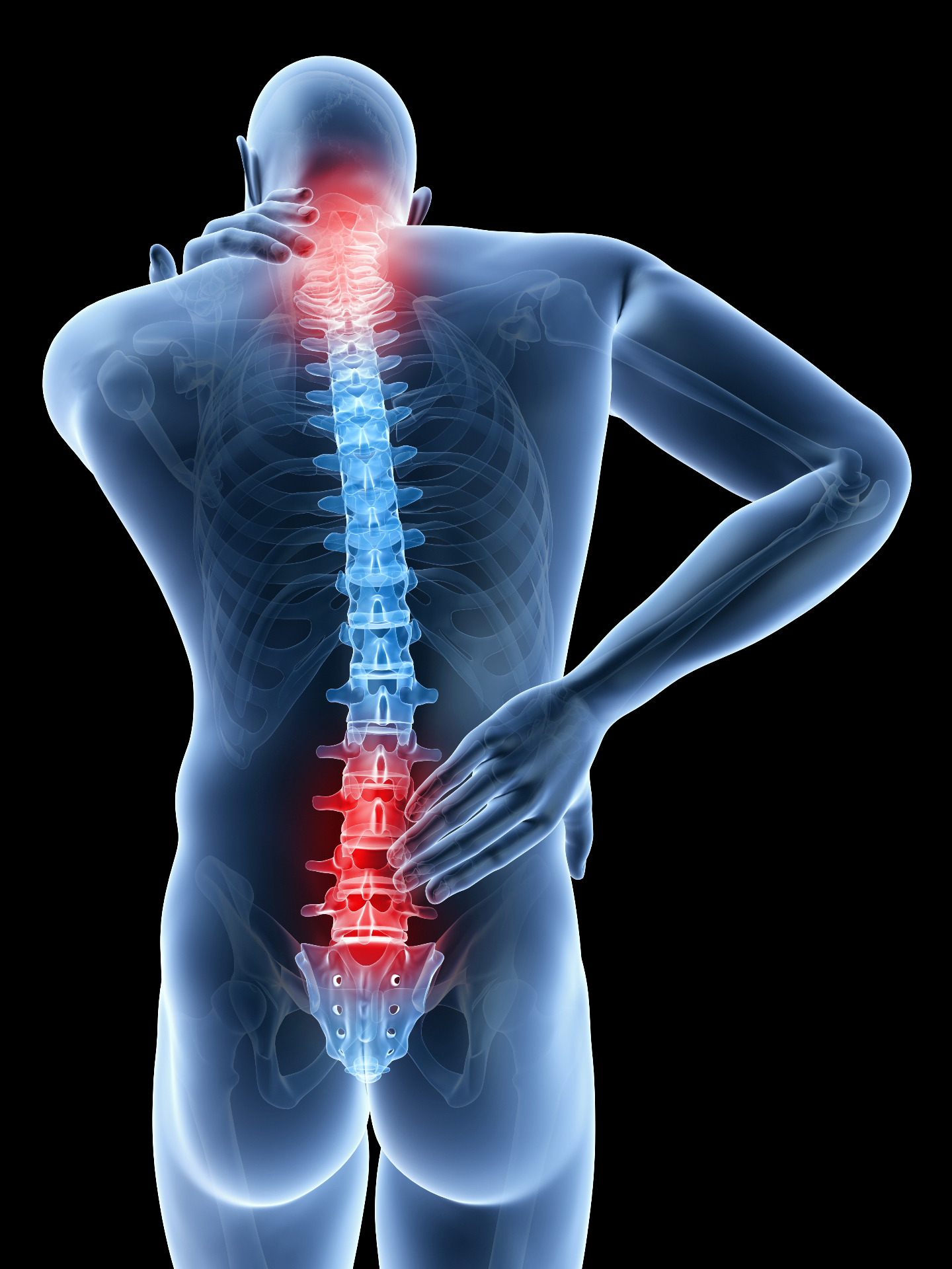 Spinal pain points — back and neck