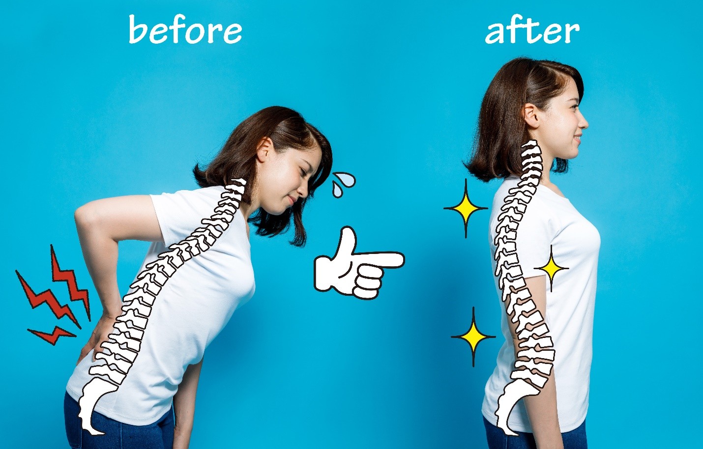 Posture before and after spondylosis treatment
